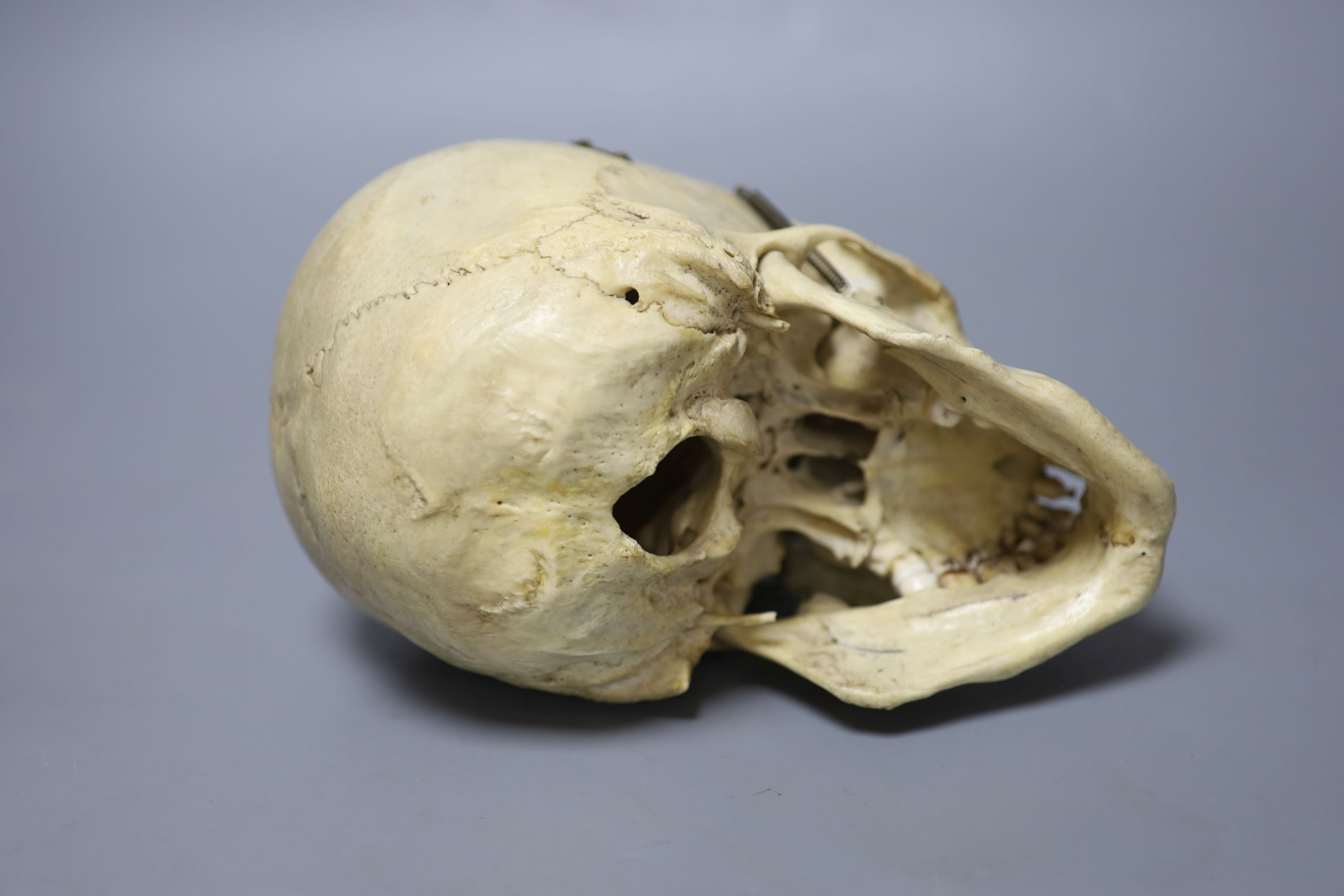 A human skull, with removable cranium and sprung jaw, height 16cm